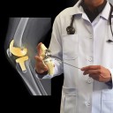 Total Knee Replacement