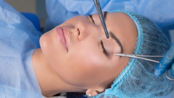 Blepharoplasty: duration, cost and step by step