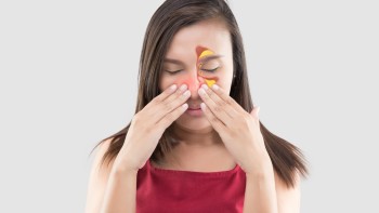 Turbinate Inflammation: what it is, causes, symptoms and treatment