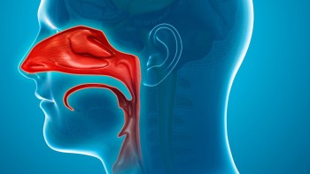 Turbinate hypertrophy: what are they, causes, symptoms and treatment