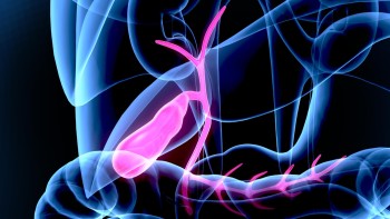 Postoperative period after laparoscopic gallbladder removal surgery