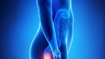 Types of Haemorrhoids