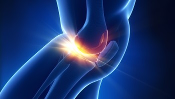 Types of meniscal injuries: Medial meniscus injury