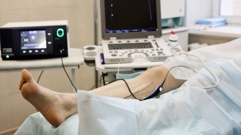 Laser Varicose Vein surgery: duration, cost and step by step
