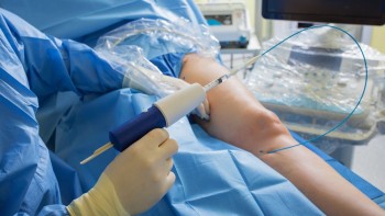 Varicose vein surgery: duration, cost and step by step