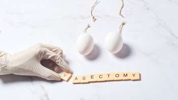 Vasectomy postoperative period