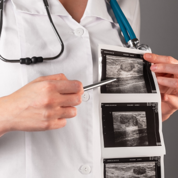 Breast ultrasound (High Precision)
