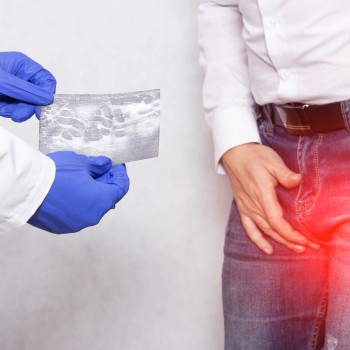Testicular Ultrasound