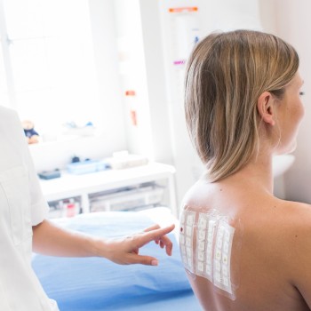 Patch Test (for skin allergy)