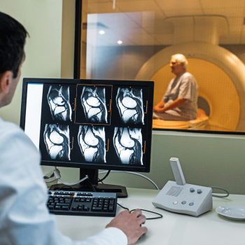 Multiparametric MRI Prostate
