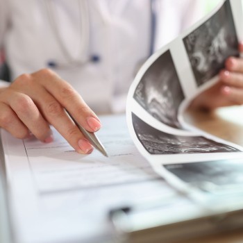 Gynaecological Ultrasound + Private Consultation