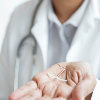 IUD removal