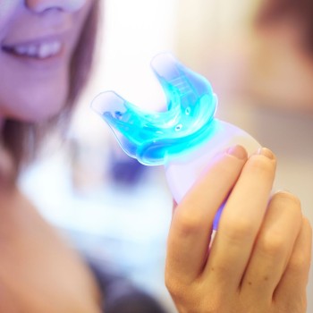 Teeth whitening (at home)