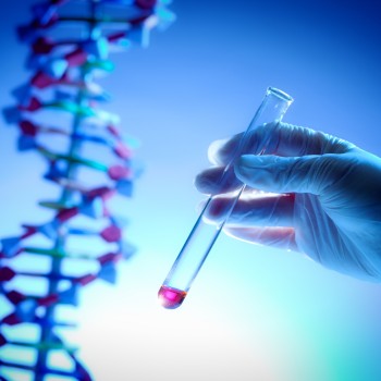 Fertility Test: Chromosome Analysis (karyotype)