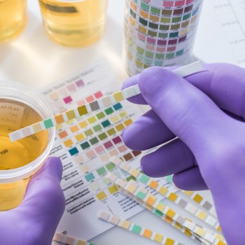 4 Drug Urine Test (Cannabis, Cocaine, Amphetamines, and Opiates)