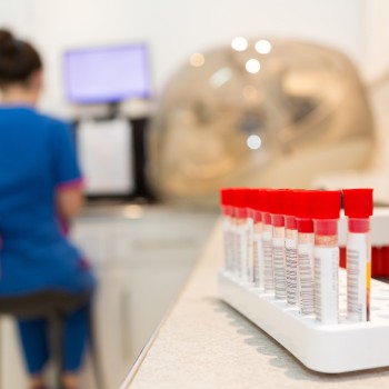 Complete STD/STI detection test