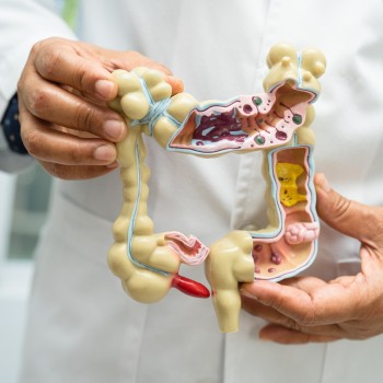 Basic Gut Microbiome Test