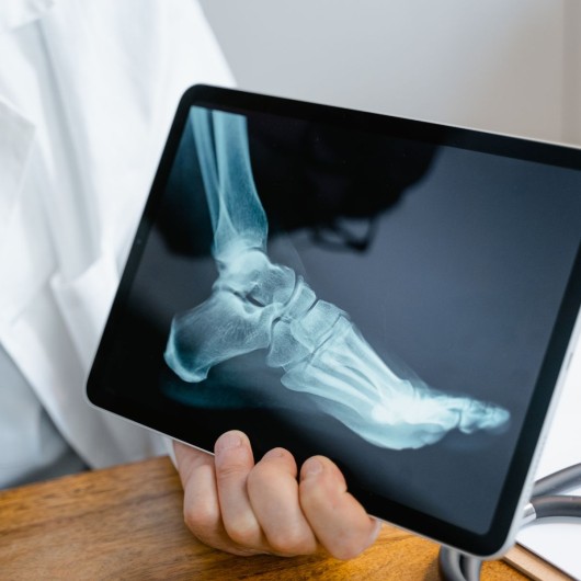 Ankle MRI