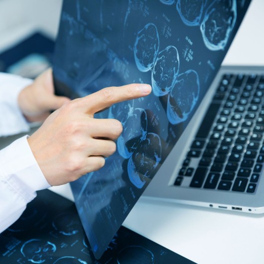 Brain MRI scan