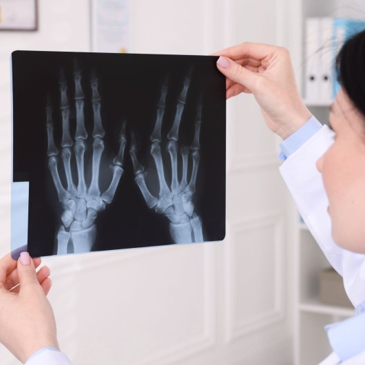 Wrist MRI