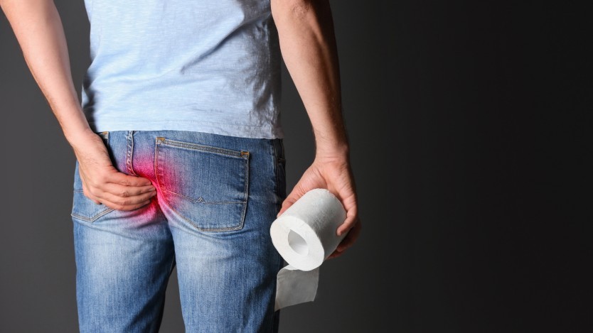 Hemorrhoids surgery