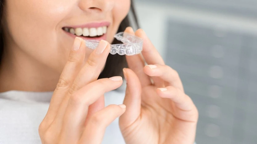 Angel aligner invisible orthodontics