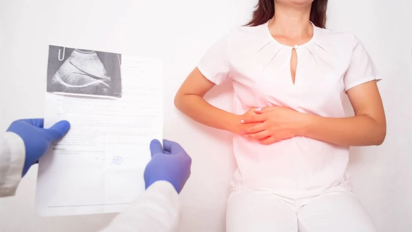 Laparoscopic Cholecystectomy
