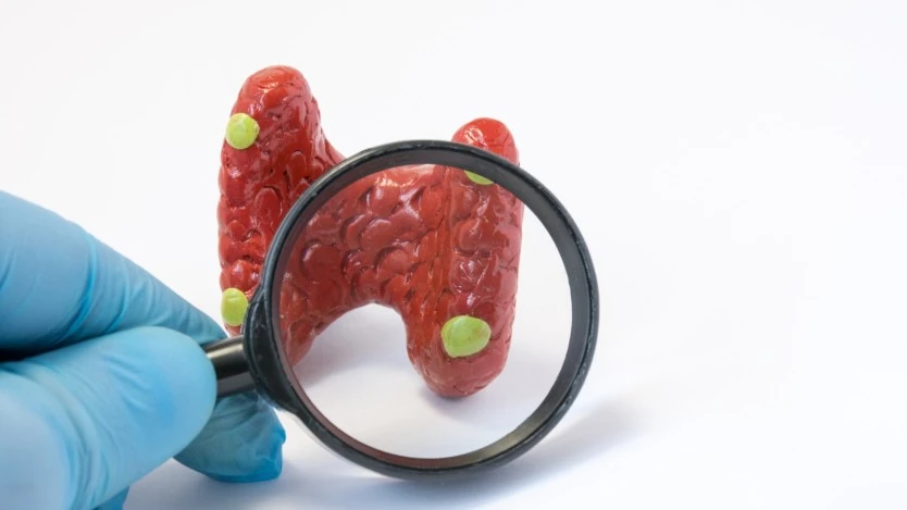 Thyroid surgery