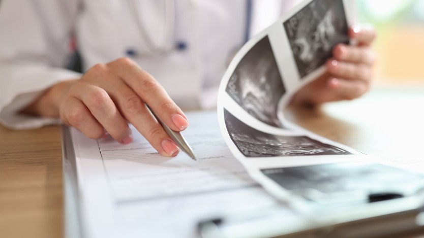 What is an ureteroscopy
