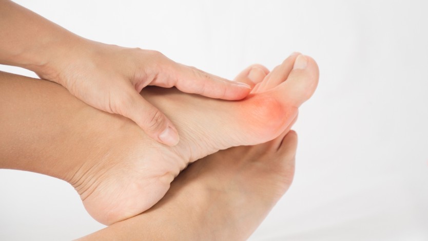 Why do bunions appear?