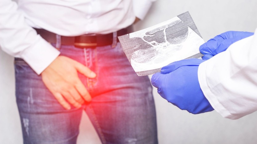 Symptoms of fluid accumulation in the testicle