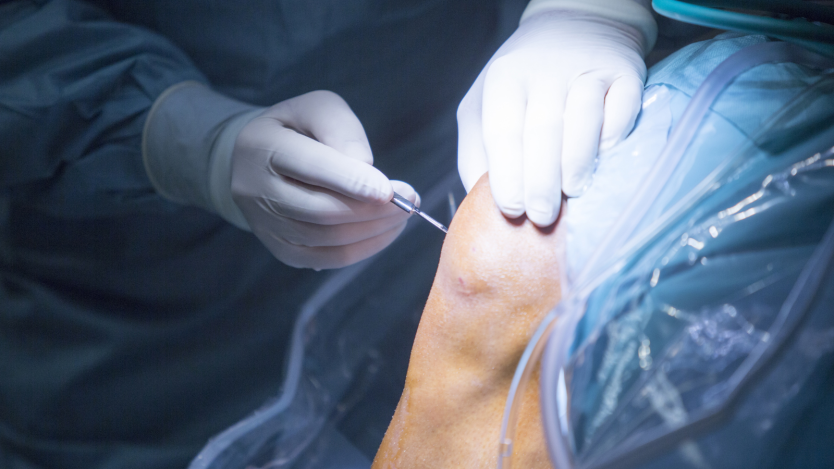 Surgeon performing arthroscopic meniscus surgery