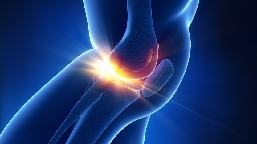 Diagnosis of a torn meniscus