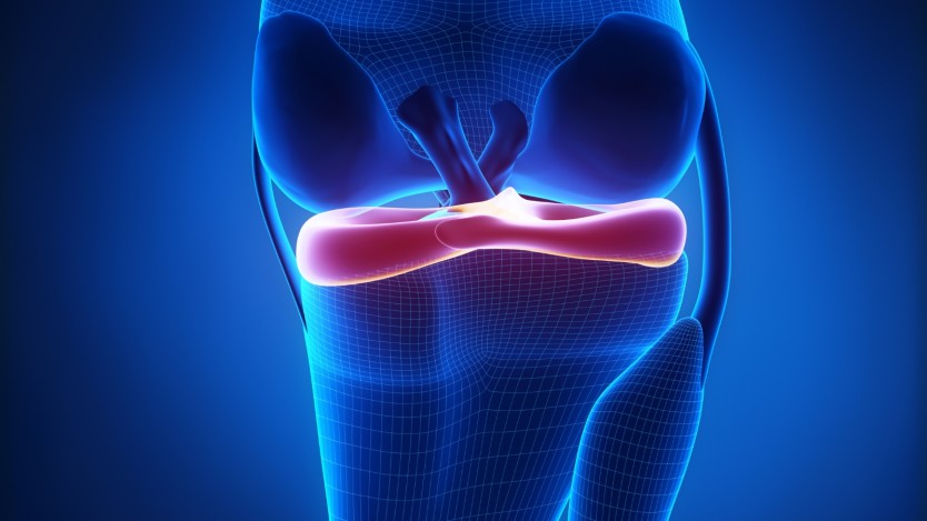 Symptoms of a torn meniscus
