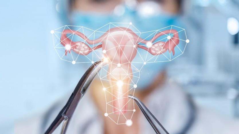 Myomectomy surgery