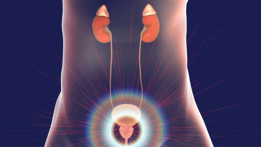Sex after a prostate surgery