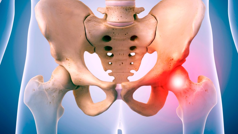 Pain in the hip area