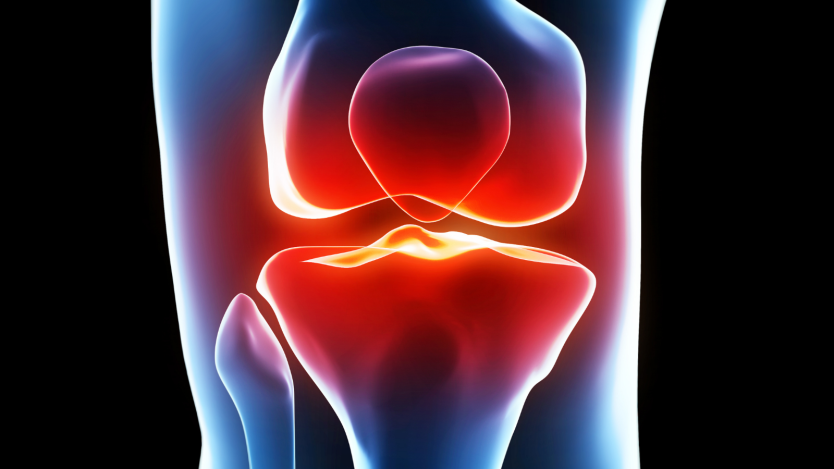 X-ray image of pain in the knee
