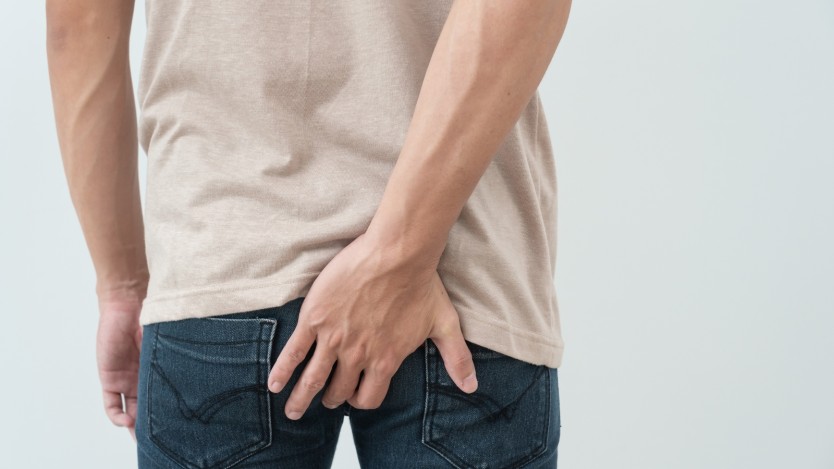 Pilonidal-cyst