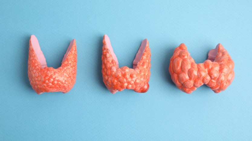 Picture of three thyroid glands