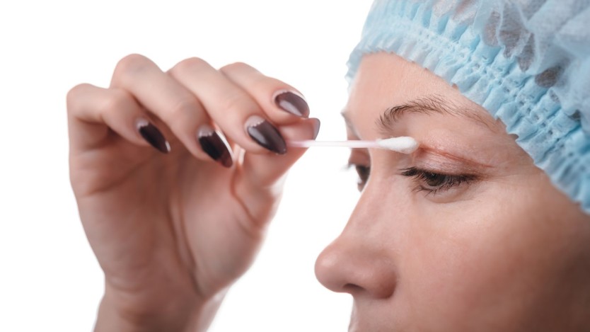 Recovery time after blepharoplasty