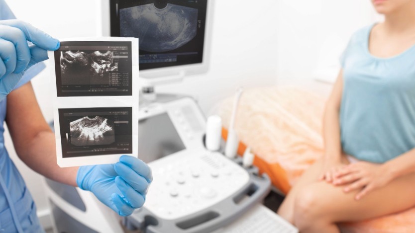 Types of surgery to remove the uterus