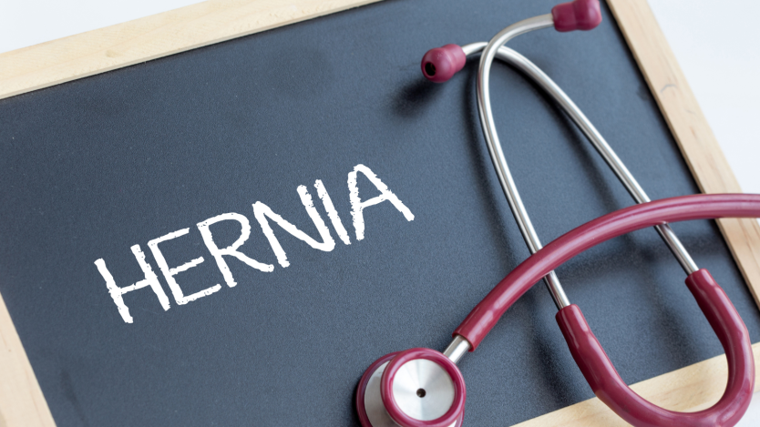Inguinal Hernia: What is it, Causes, Types, Symptoms and Treatment
