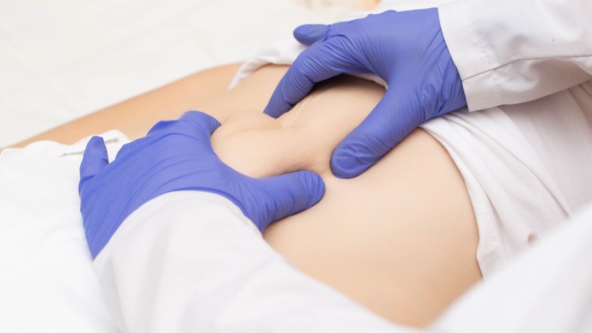 Umbilical hernia in adults, is surgery necessary?