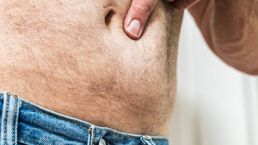 Abdominal hernia: what is it, types, surgery and postoperative period