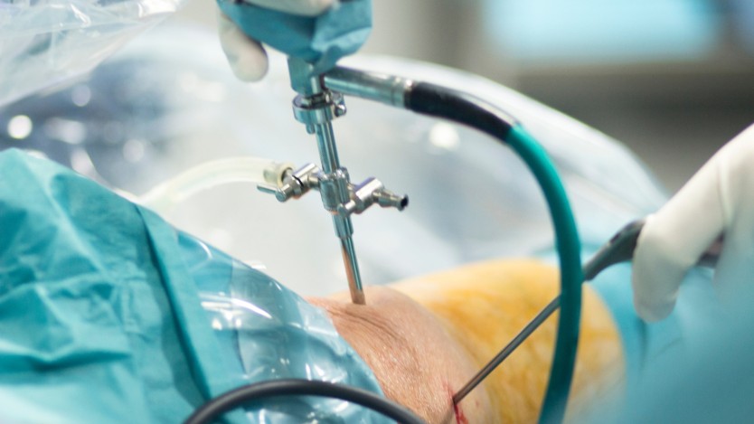 How is a cruciate ligament repaired by arthroscopy?