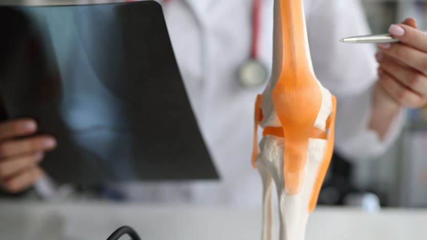 Meniscectomy: what it is, types, advantages and complications