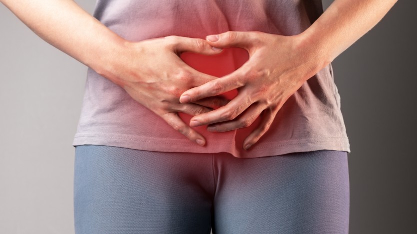 Subserosal fibroids