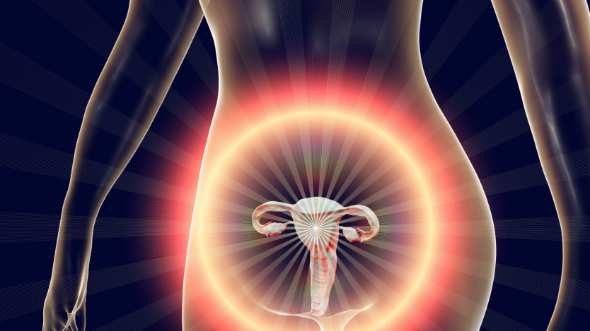 Intramural uterine fibroids